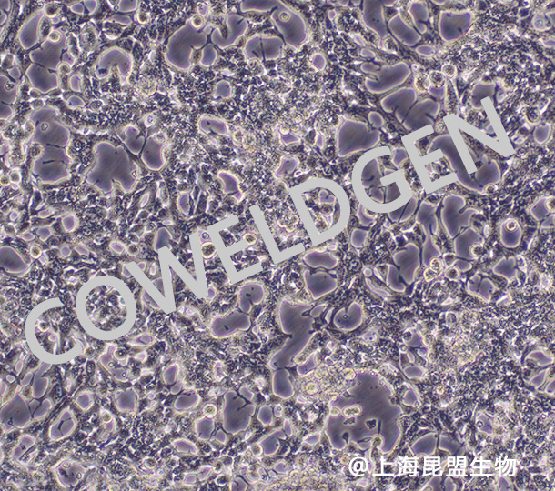 LNCaP clone FGC 人前列腺癌细胞